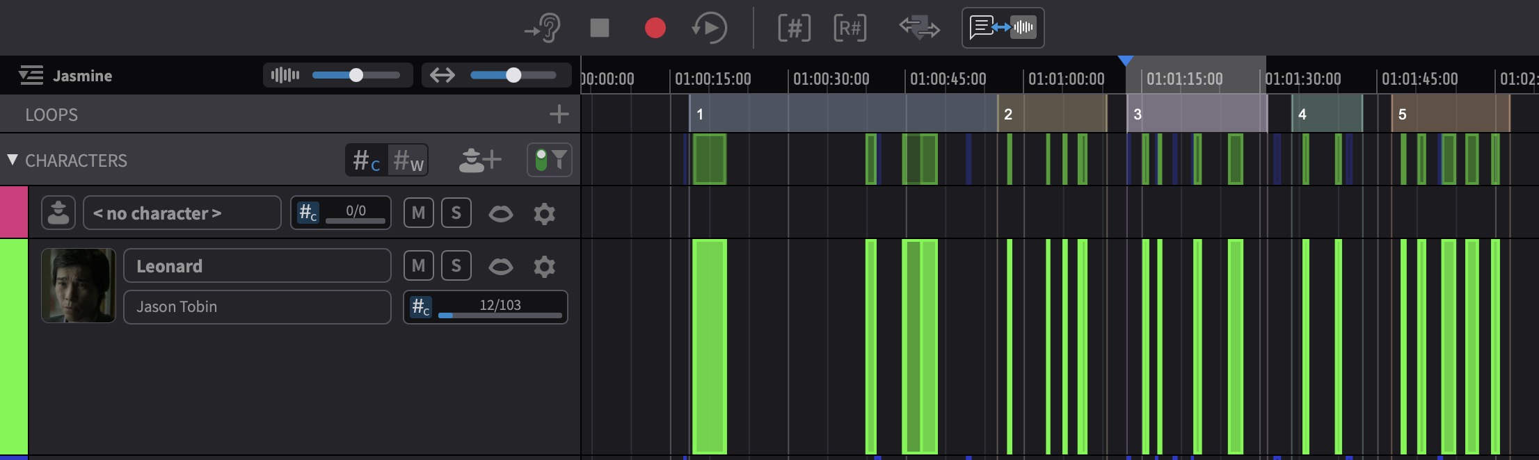 LOOPS track showing coloured loops with IDs across the timeline